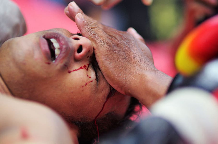 How Dangerous Is Muay Thai?